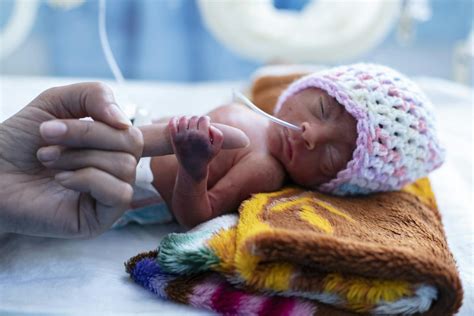 Bambino prematuro in incubatrice