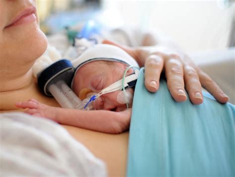 Madre con neonati prematuri in contatto pelle a pelle