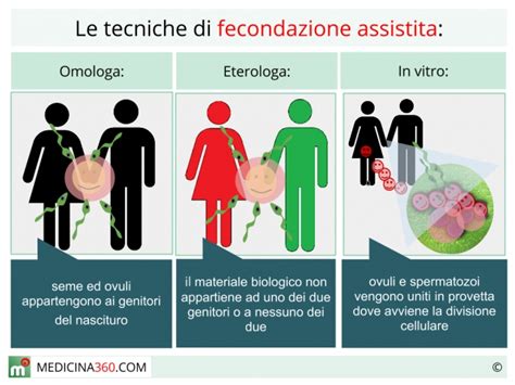 Diagramma che illustra le differenze tra fecondazione omologa ed eterologa