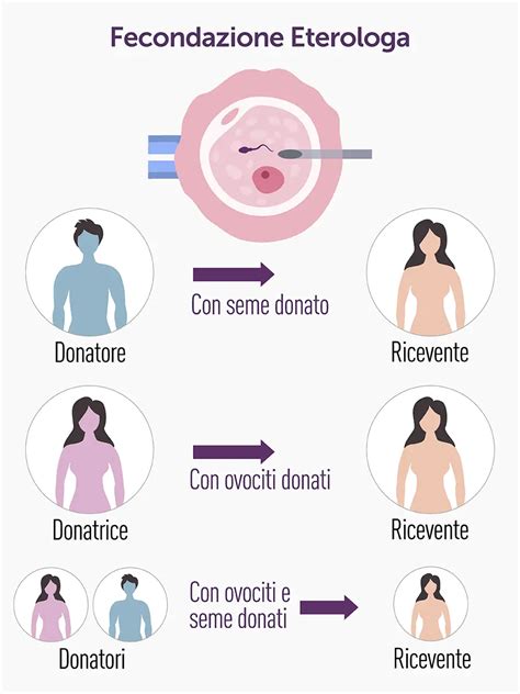Mappa dell'Europa con evidenziati i diversi approcci alla fecondazione eterologa
