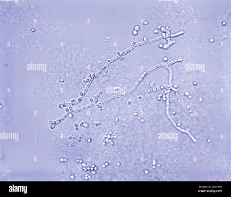 Microscopio che mostra la Candida albicans