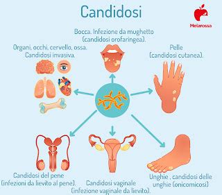 Infografica: Passaggi per prevenire e trattare la candida durante l'allattamento