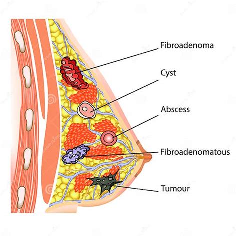 Illustrazione anatomica del seno femminile con evidenziate le zone erogene.