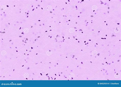 Microscopio che osserva batteri nel liquido amniotico