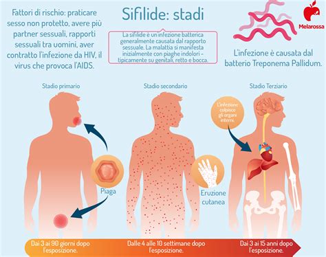 Schema della trasmissione della sifilide da madre a feto
