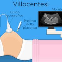 Ecografia durante villocentesi