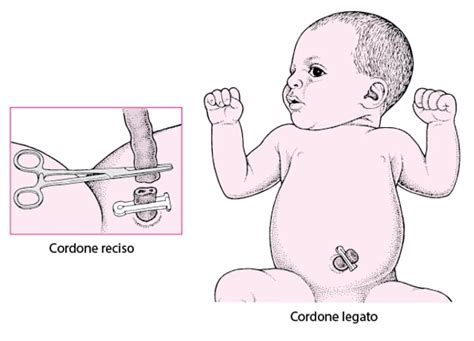 Strumenti medici per il taglio del cordone ombelicale