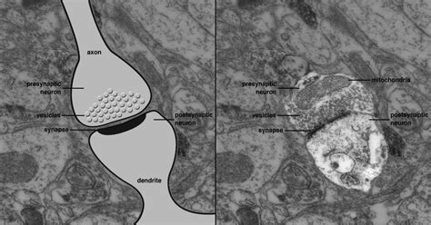 Microscopio elettronico che mostra neuroni impregnati d'argento