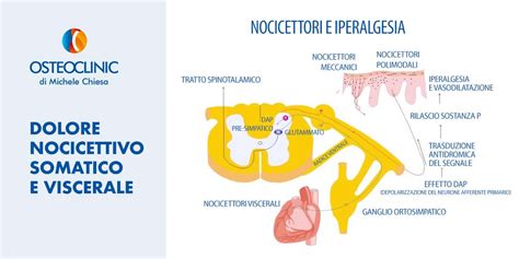 Diagramma che illustra la differenza tra dolore somatico e viscerale