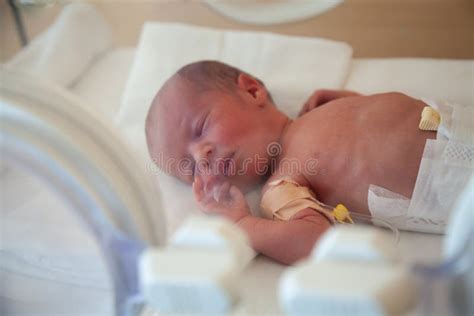 Neonato in incubatrice