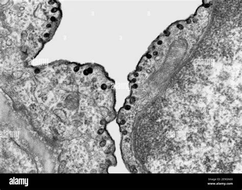Micrografia elettronica di Chlamydia abortus