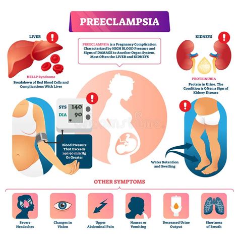 Diagramma che mostra i sintomi della preeclampsia