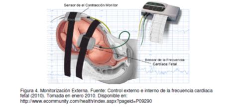 Monitoraggio cardiotocografico