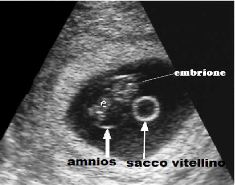 Grafico che illustra la crescita del sacco vitellino e dell'embrione nelle prime settimane