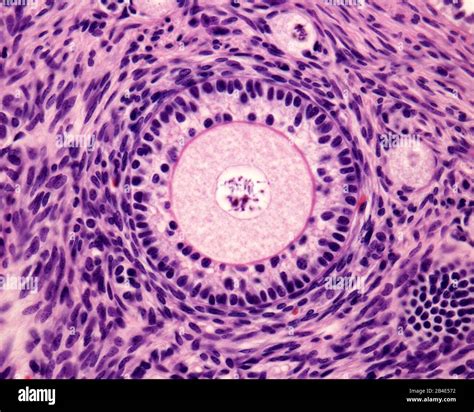 Immagine al microscopio di un ovocita con fuso meiotico II visibile