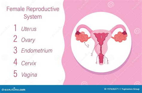 Diagramma del sistema riproduttivo femminile con aree potenzialmente interessate dall'ureaplasma
