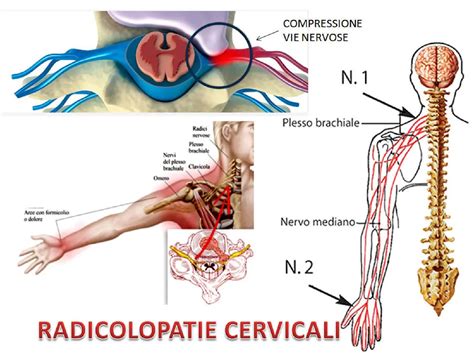 Diagramma della Sindrome Trasfuso-Trasfusore