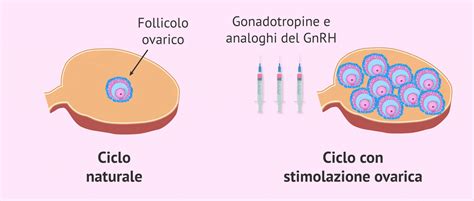 Schema del processo di stimolazione ovarica e prelievo ovocitario