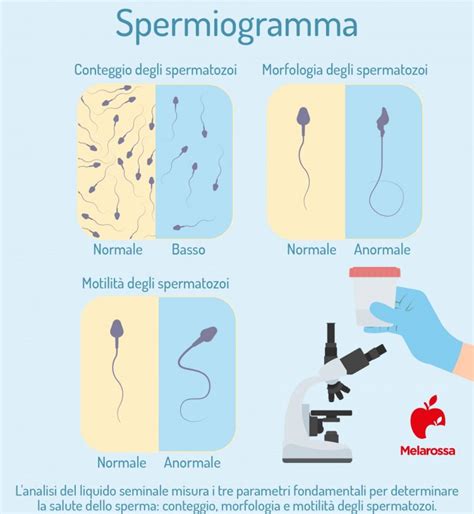 Diagramma che illustra i parametri di uno spermiogramma: concentrazione, motilità e morfologia