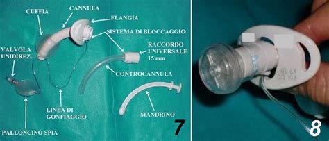 Immagine che raffigura una cannula per l'isterosuzione