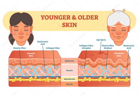 illustrazione di pelle infantile e adulta a confronto