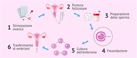 Schema del processo di Fecondazione In Vitro (FIVET)