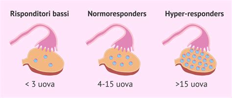 Grafico che mostra la distribuzione delle risposte alla stimolazione ovarica (low, normo, hyper responder)