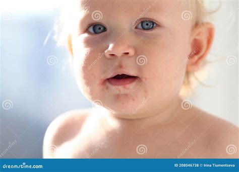 Bambino con eruzione cutanea