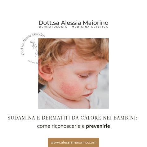 bambino con sudamina sul collo