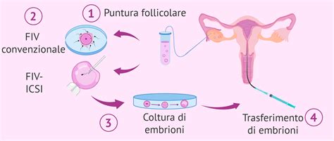 Schema del processo di fecondazione in vitro (FIV)