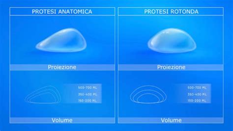 Illustrazione comparativa delle posizioni retroghiandolare e retromuscolare delle protesi mammarie