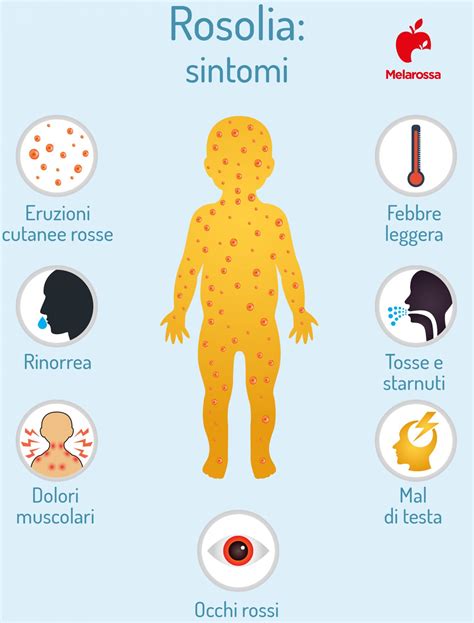 Schema della diffusione dell'esantema da rosolia