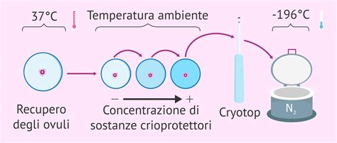 Schema che illustra il processo di vitrificazione degli ovociti