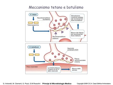 Schema del sistema nervoso con effetti della tossina tetanica sui muscoli