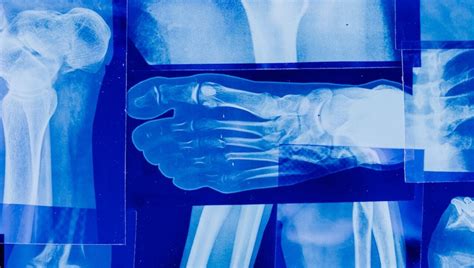 Radiografia di un'articolazione