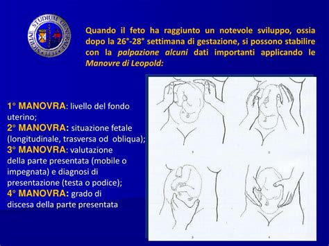 Manovre di Leopold per la valutazione della posizione fetale
