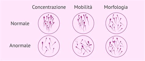 Infografica che illustra i parametri chiave di uno spermiogramma