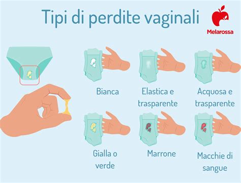 Infografica che confronta i sintomi e le cause di vaginite, candida e cervicite.