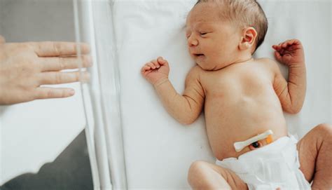 neonato con moncone ombelicale