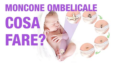 Neonato con moncone ombelicale