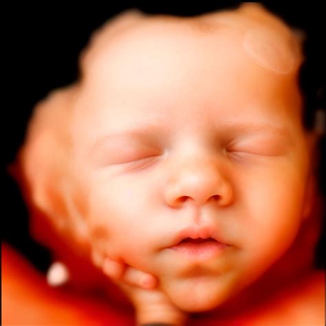 Ecografia 4D che mostra espressioni facciali fetali