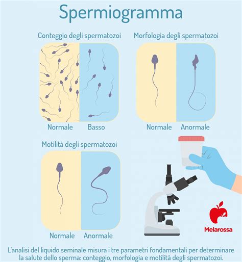 Diagramma che illustra i parametri dello spermiogramma: concentrazione, motilità e morfologia degli spermatozoi