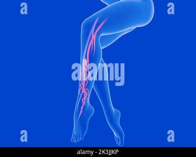 Diagramma del sistema venoso delle gambe con enfasi sulle valvole