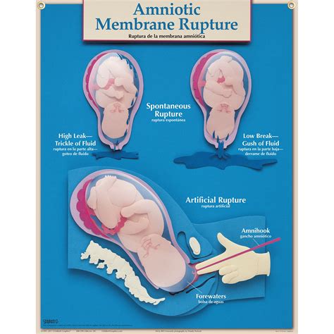 Scollamento delle membrane