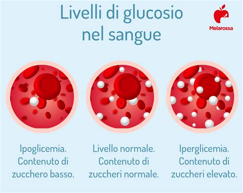 schema che illustra i livelli di glucosio nel sangue e l'ipoglicemia