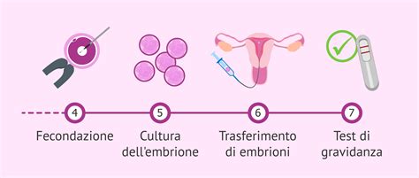 Schema della Fecondazione In Vitro