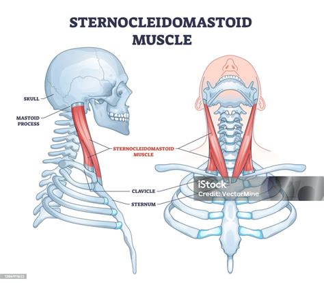 Diagramma anatomico del muscolo sternocleidomastoideo