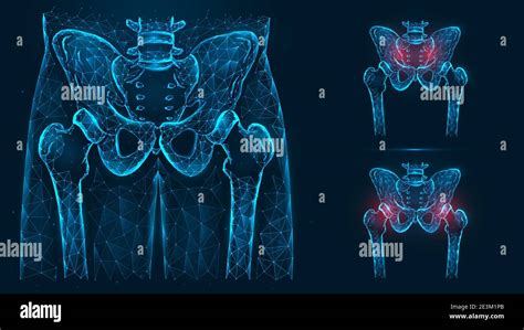 Diagramma anatomico dell'articolazione dell'anca umana