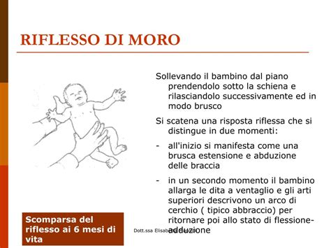 Bambino neonato che esegue il riflesso di Moro