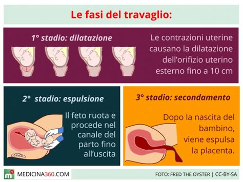 Diagramma delle fasi del travaglio e del parto